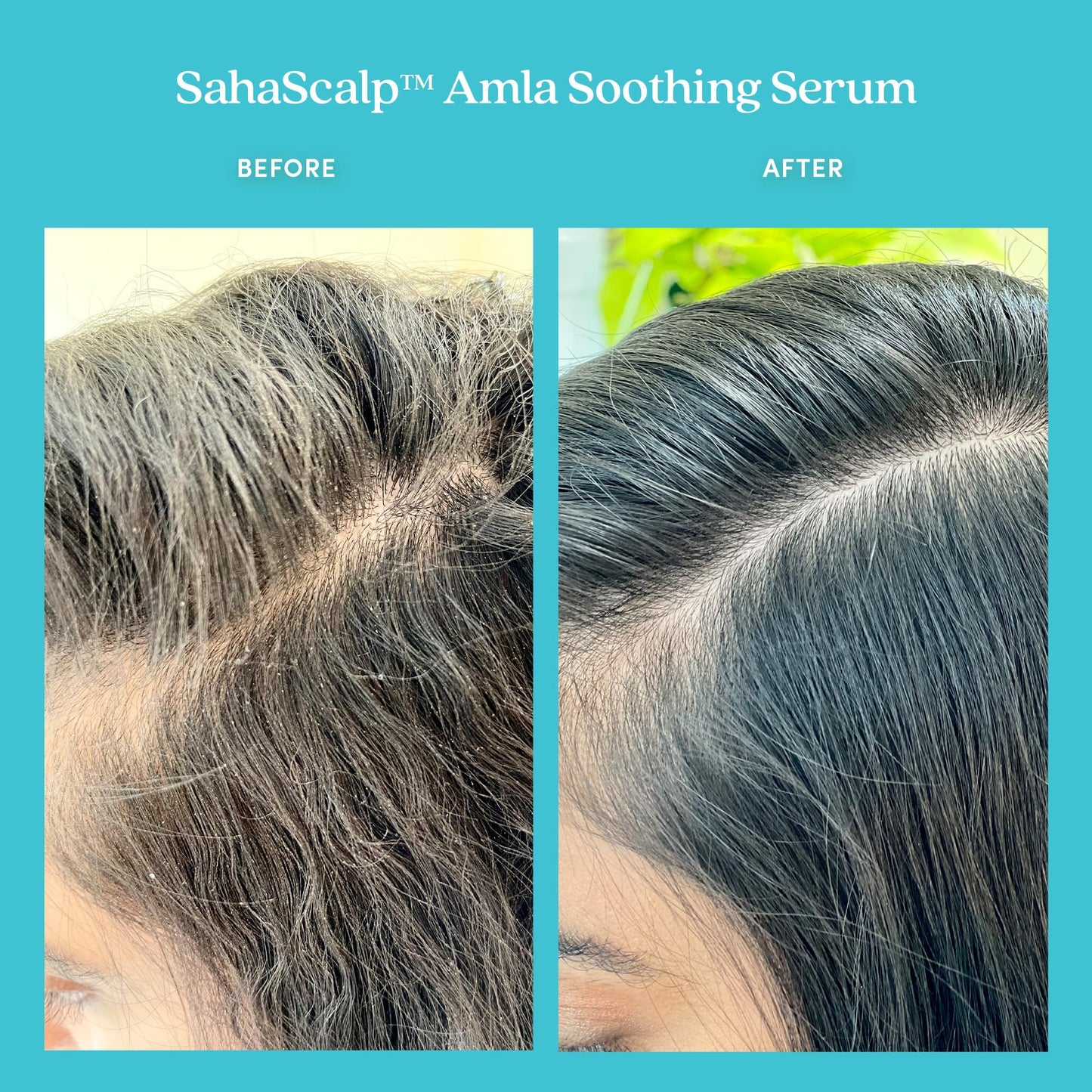 Fable & Mane SahaScalp AMLA Soothing Serum for all hair types 1.8 fl oz