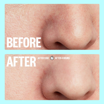 PEACE OUT Skincare Pore Minimizing Strips,