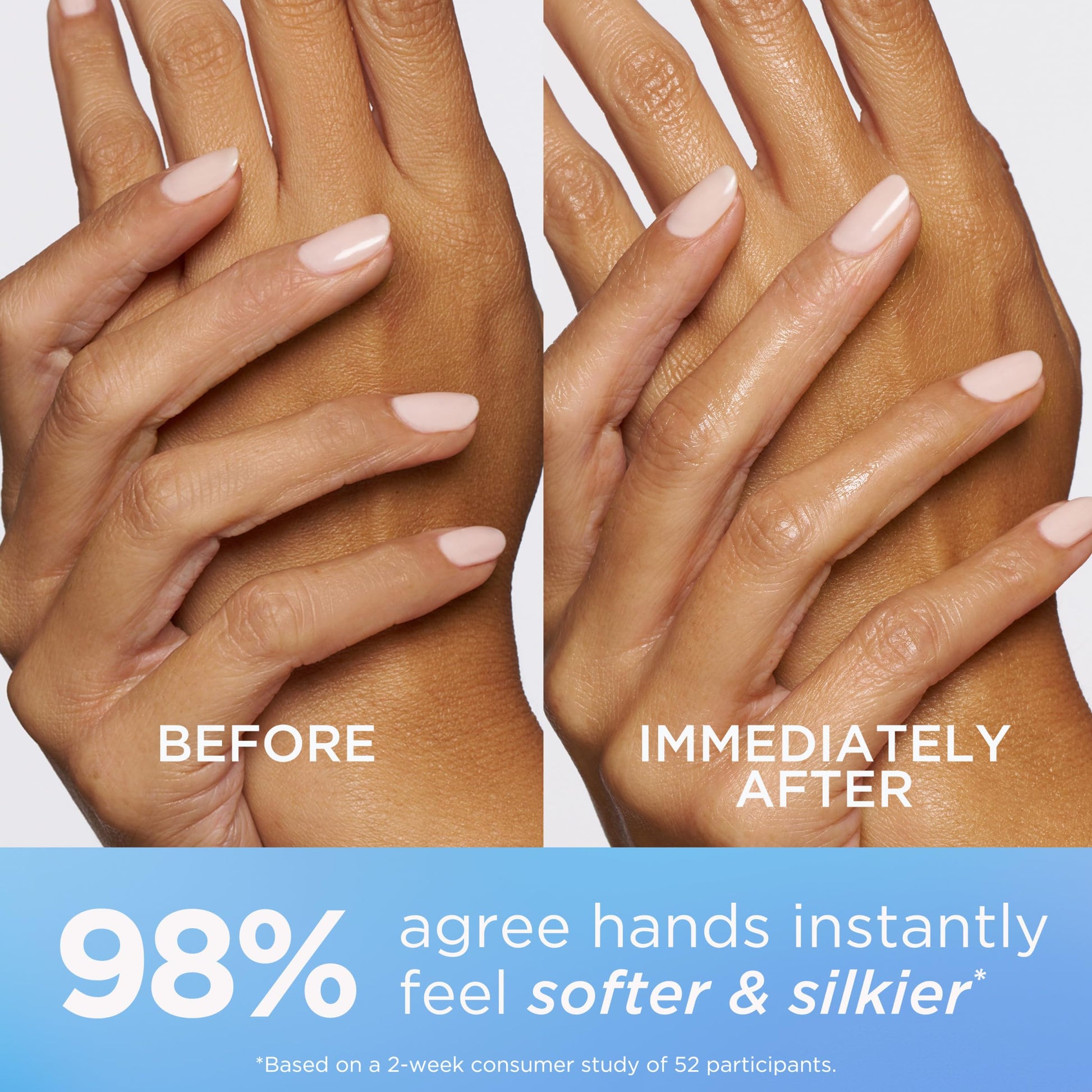 Before-and-after comparison of hands: improved skin texture.