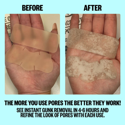 PEACE OUT Skincare Pore Minimizing Strips,