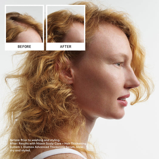 Nioxin Scalp + Hair Thickening System 1 Shampoo 33.8 oz